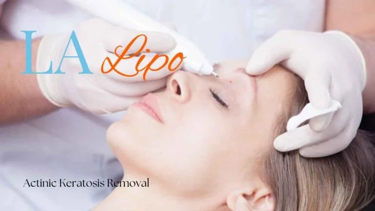 Woman receiving Actinic Keratosis Removal Treatment Tilbury