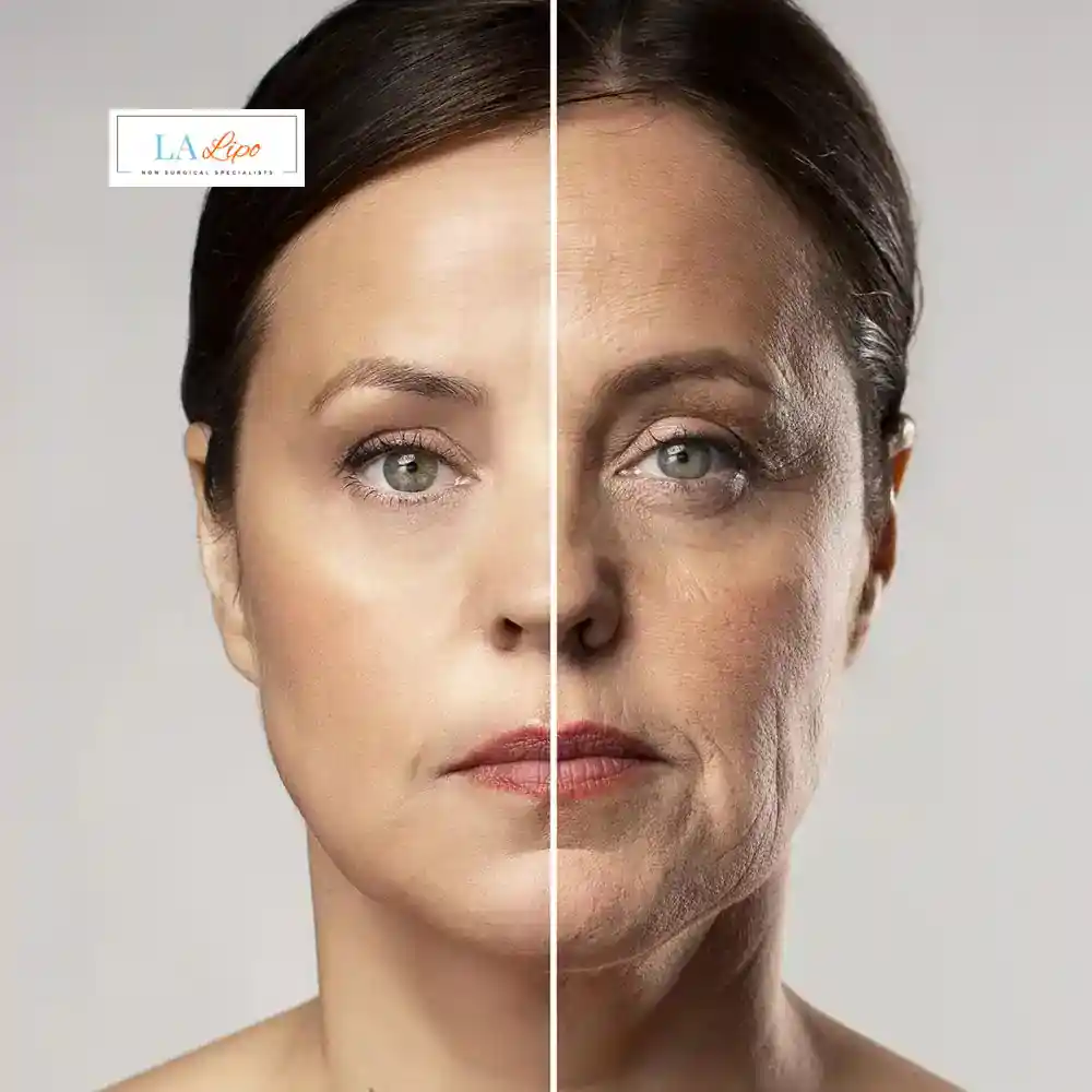 How Can You Tell If Non-Surgical Skin Tightening Is Right for You Tilbury?