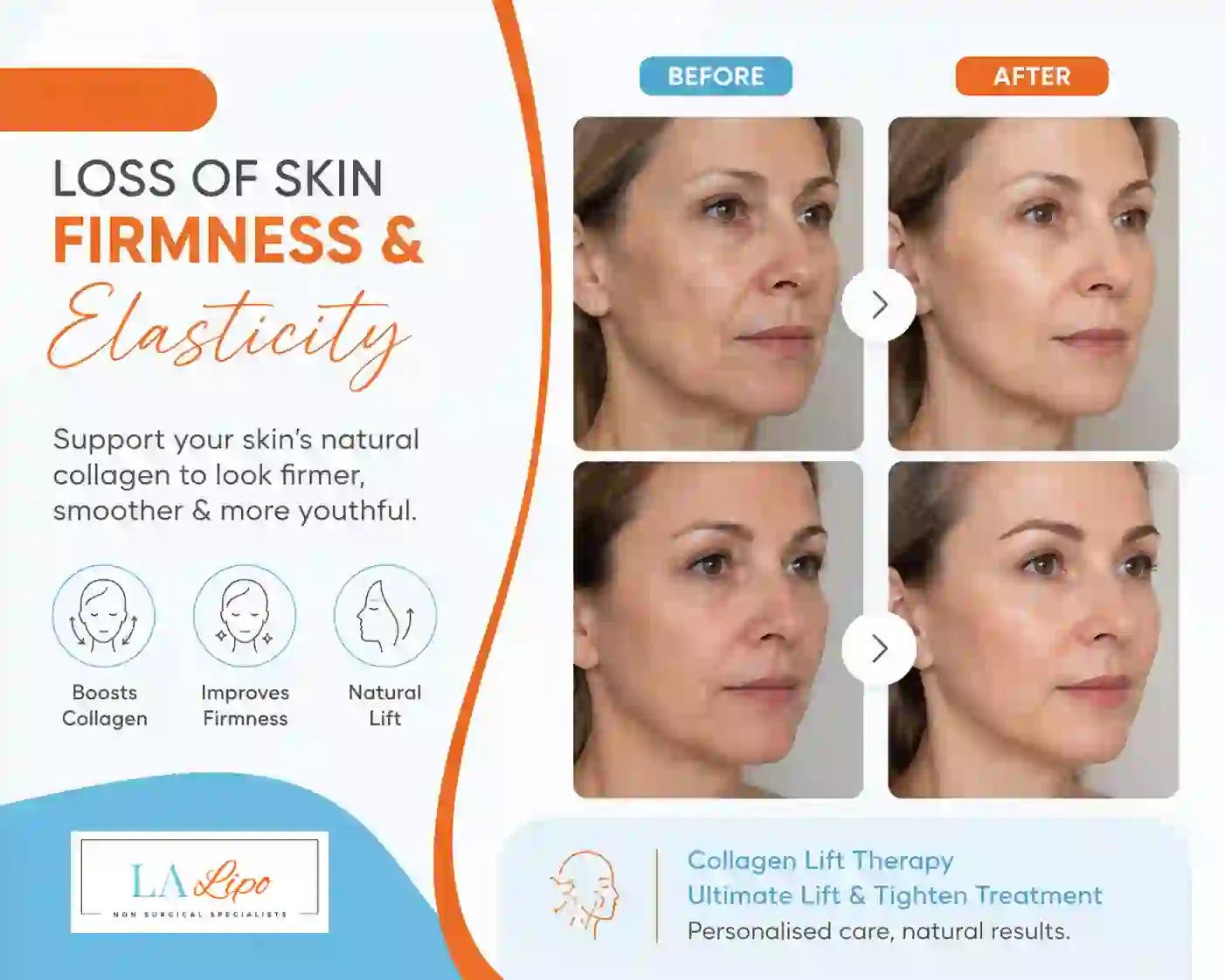 Sign #7: Loss of Skin Firmness and Elasticity Tilbury